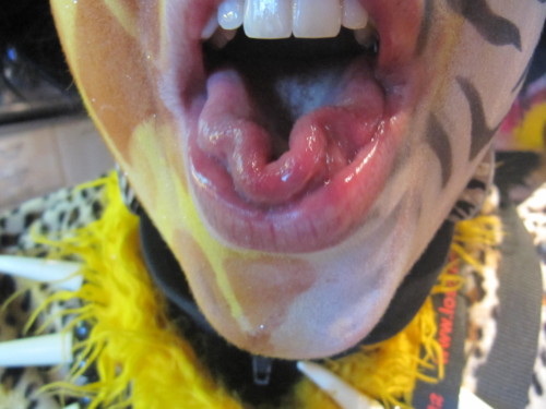 Brandons d'Yverdon 2011