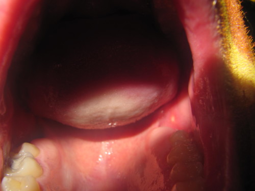 Brandons d'Yverdon 2011