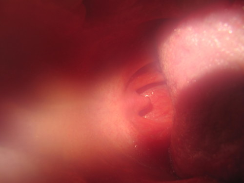 Brandons d'Yverdon 2011