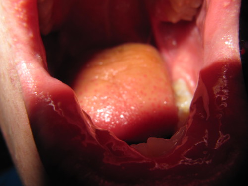 Souper de soutien 2011